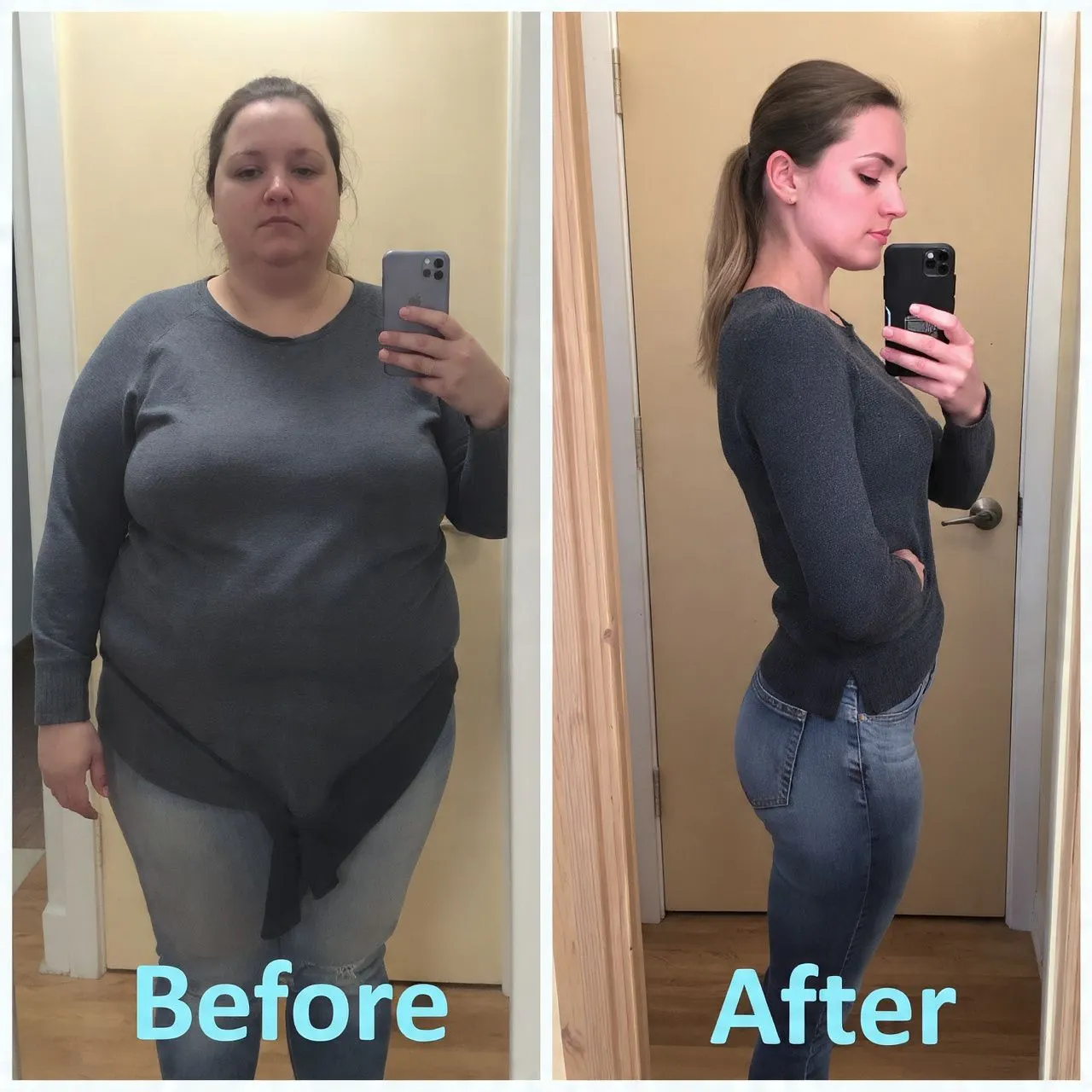 Patient result 6 - Cancun Bariatric